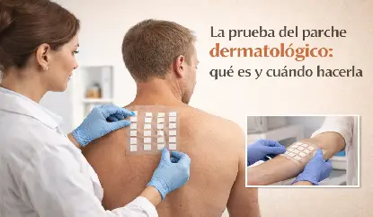 Dermatólogo realizando la prueba del parche