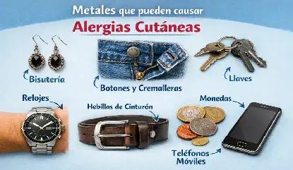 Objetos cotidianos que causan alergia a los metales: bisutería, botones, cremalleras, relojes, hebillas, llaves, monedas y teléfonos móviles